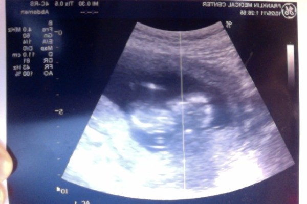 Photo on 10-26-11 at 11.03 AM